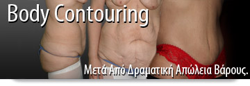 body contouring